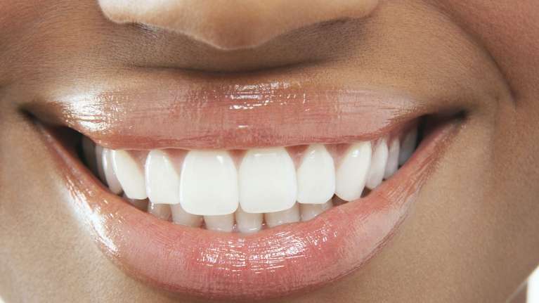 close up of woddland hills woman's smile