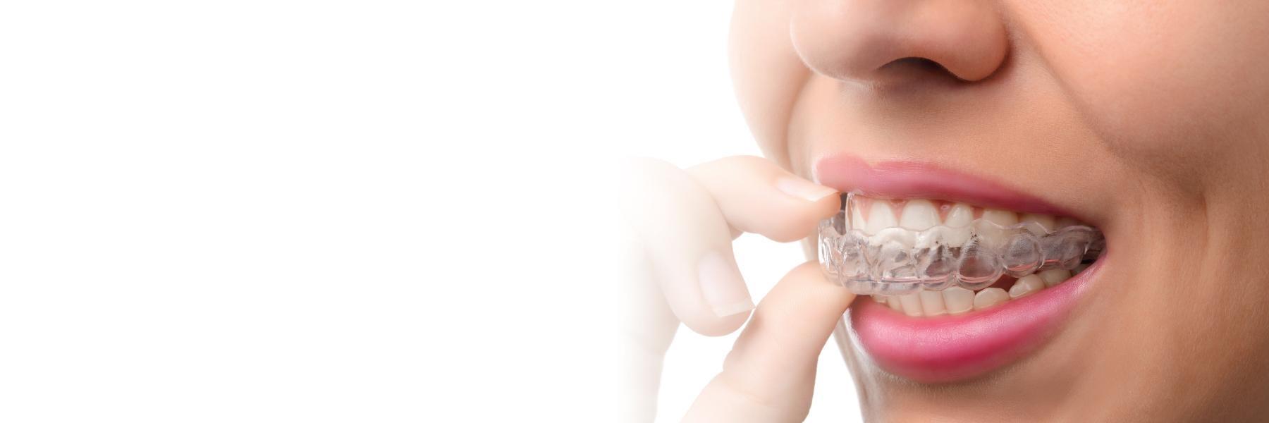 woman using invisalign in woodland hills
